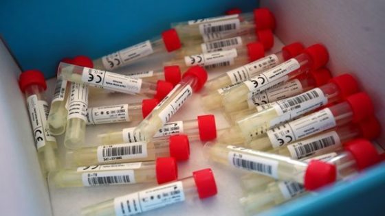 ولاية ألمانية تشدد قواعد مكافحة كورونا لمن لم يتلقوا التطعيم