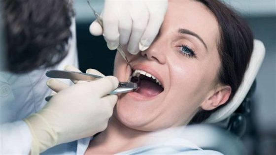 العجز الكبير في كادر أطباء الأسنان يجبر الناس على خلع أسنانهم بأنفسهم