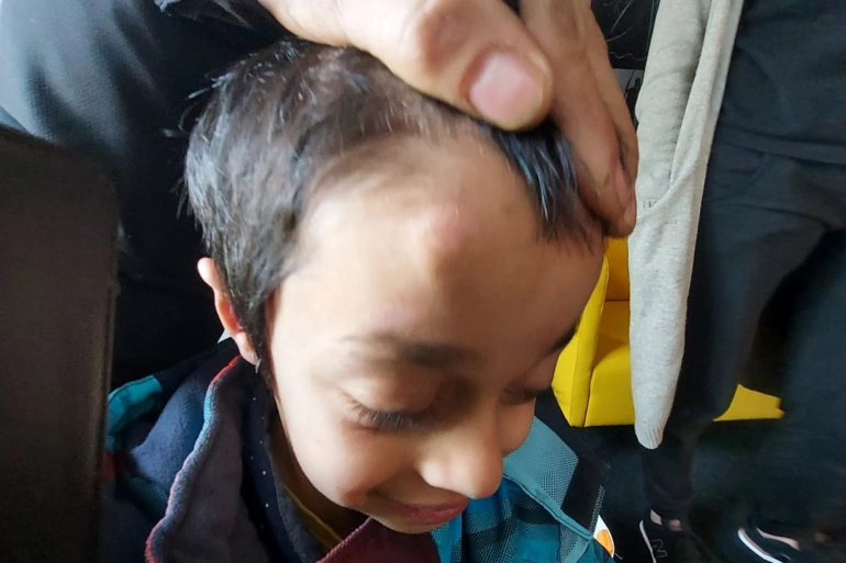 الطفل محمد والذي سحبه موظفو يوغند آمت بسبب تعرض رأسه لإصابة