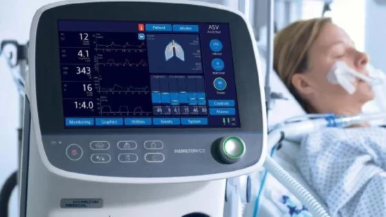 ألمانيا: مريضة توقف جهاز التنفس الصناعي لزميلتها في الغرفة لانزعاجها